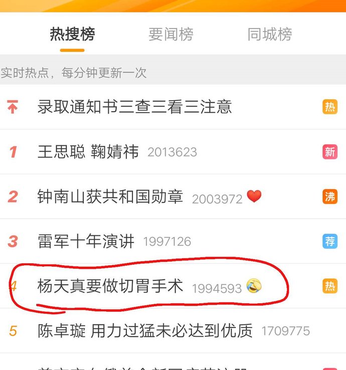  糖尿病|杨天真为什么要做切胃术？