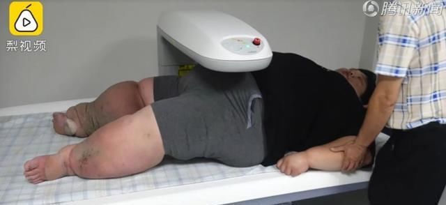  减肥手术|想减肥？养只狗吧！这只狗狗帮主人一年瘦了260多斤