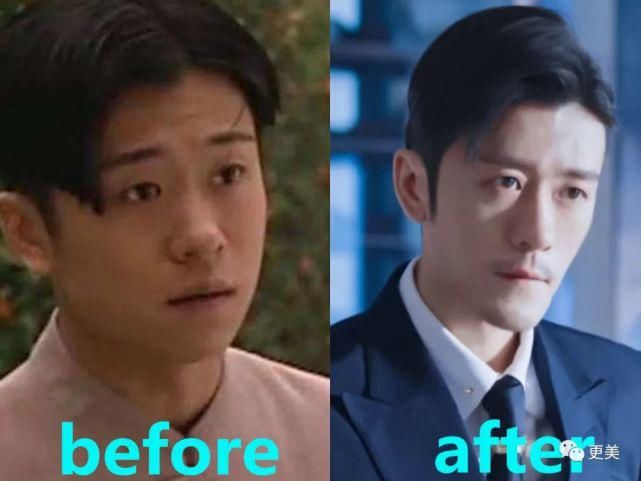  背靠|贵圈首个do成锥子脸的男星，背靠资本压番顶流小生，真宝藏