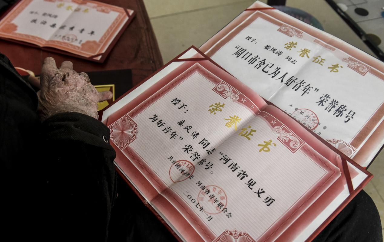  容貌|男子火中勇救2人曾获荣誉无数，帅气容貌被毁不敢见人