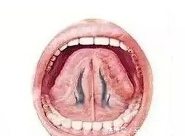 小林|27岁女子,突发猝死,身体出现1肿、2紫、3多,去查查心脏