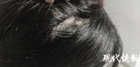  扔下|熊孩子六楼扔下指甲刀，砸伤楼下路人