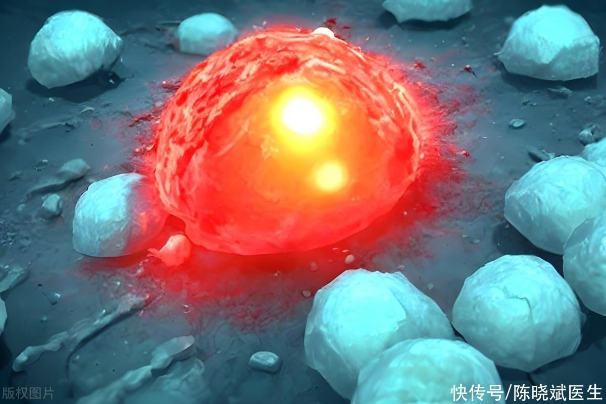 治疗甲流疗效比较好的中成药(甲流年年有，为何今年“特别凶”？3个中成药，给身体加层保护罩)