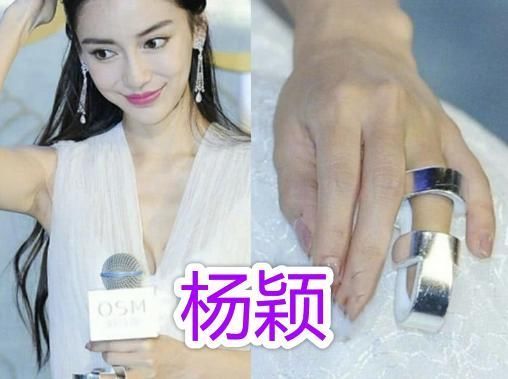 血流|明星参加综艺节目有多危险邓超打石膏、baby骨折,而他血流不止