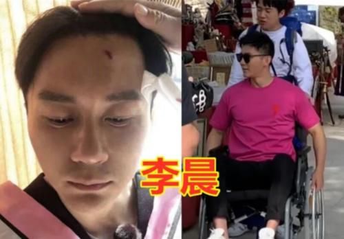  明星|明星录综艺时的意外，张艺兴晕倒，baby手指骨折，她被搭档摔成脑震荡！