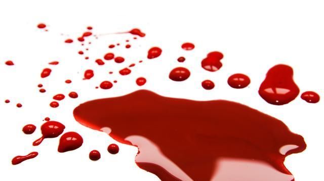  痔疮|如何消除痔疮肉球？这几个习惯要养成，消除特殊部位的困扰