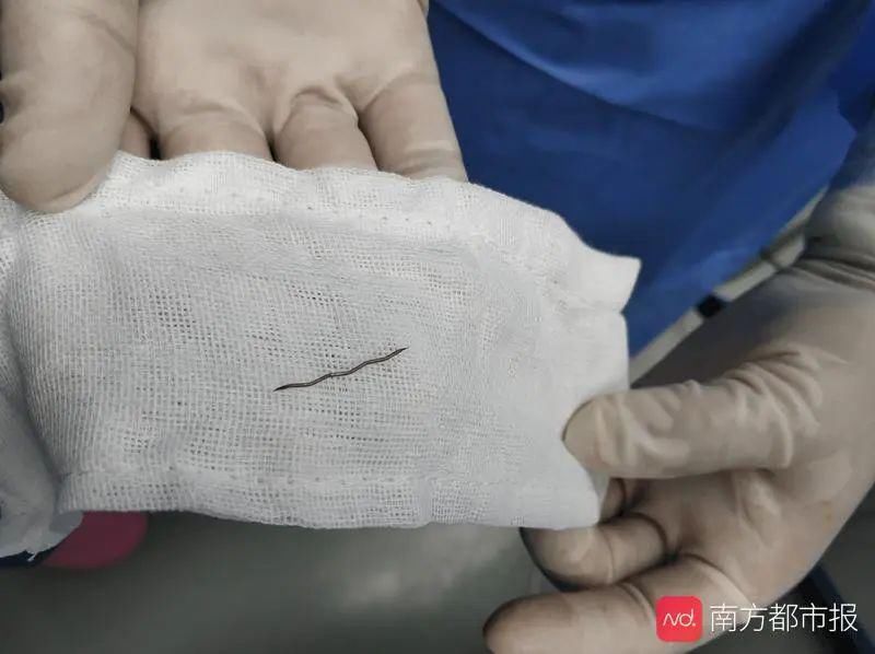  难忍|刺痛难忍！男子以为误吞鱼刺，“元凶”万万没想到