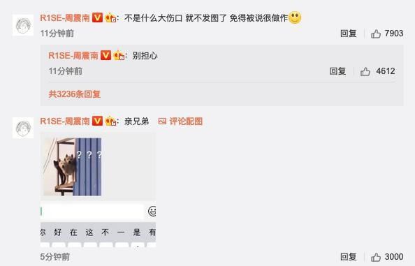  假发|爱豆出糗瞬间：王一博追星失控，孟美岐甩飞假发片，周震南被猫咬