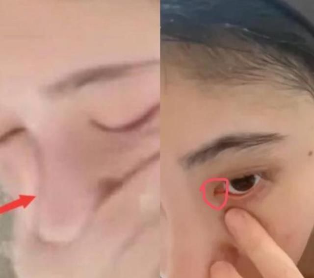 痕迹|鞠婧祎直播回应整容，当场洗脸无奈太用力，刀割痕迹不要太明显