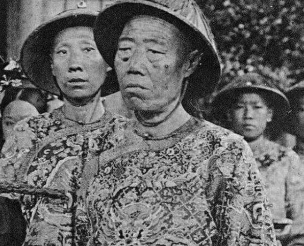 脓包|镜头下真实的太监李莲英,丑陋满脸脓包!为啥能深受宠信?