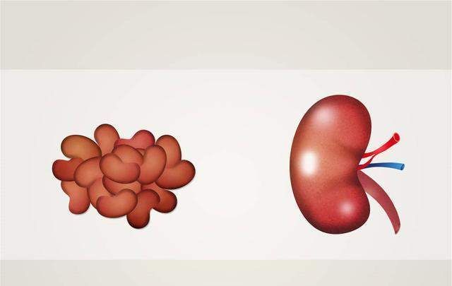  此前|男子患尿毒症，靠透析维持生命，此前身体早有提示，只是他忽视了