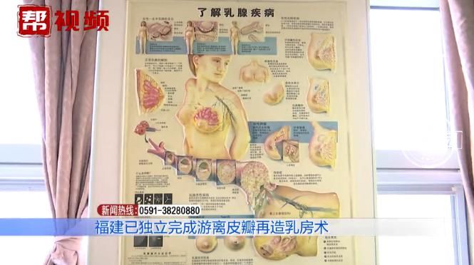 小婷|左乳皮肤潮红，一年内迅速扩散，发现时已是癌症晚期