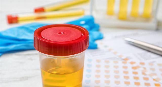  之气过重|湿气重的人，身体一般会出现“3黄”，学会祛湿方法，无湿一身轻