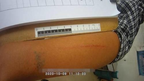 民警|丢垃圾引矛盾，斗殴两人双双进了派出所