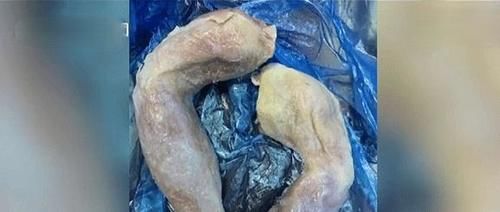 男子|男子用弹弓打下1000只斑鸠，卖给饭店老板获利万余元，双方被刑拘