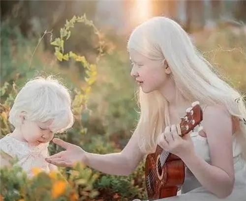  惊艳|罕见的“白雪公主”，却遭受了14年冷眼，拍完一组照片后惊艳全球